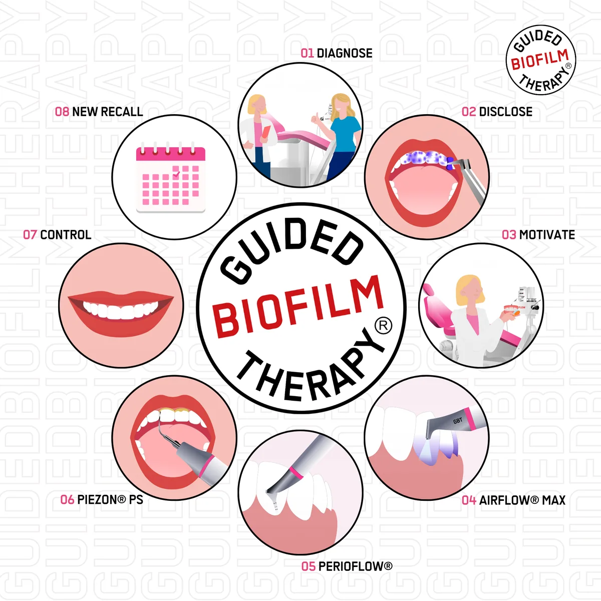 Guided Biofilm Therapy compass workflow illustration