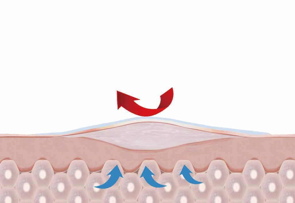 Illustration of a dressing forming a protective barrier over a wound